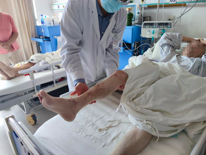 86岁上海老伯晨练摔倒瘫痪在床,到医院一查竟是危险"黑痣"已长进脊髓
