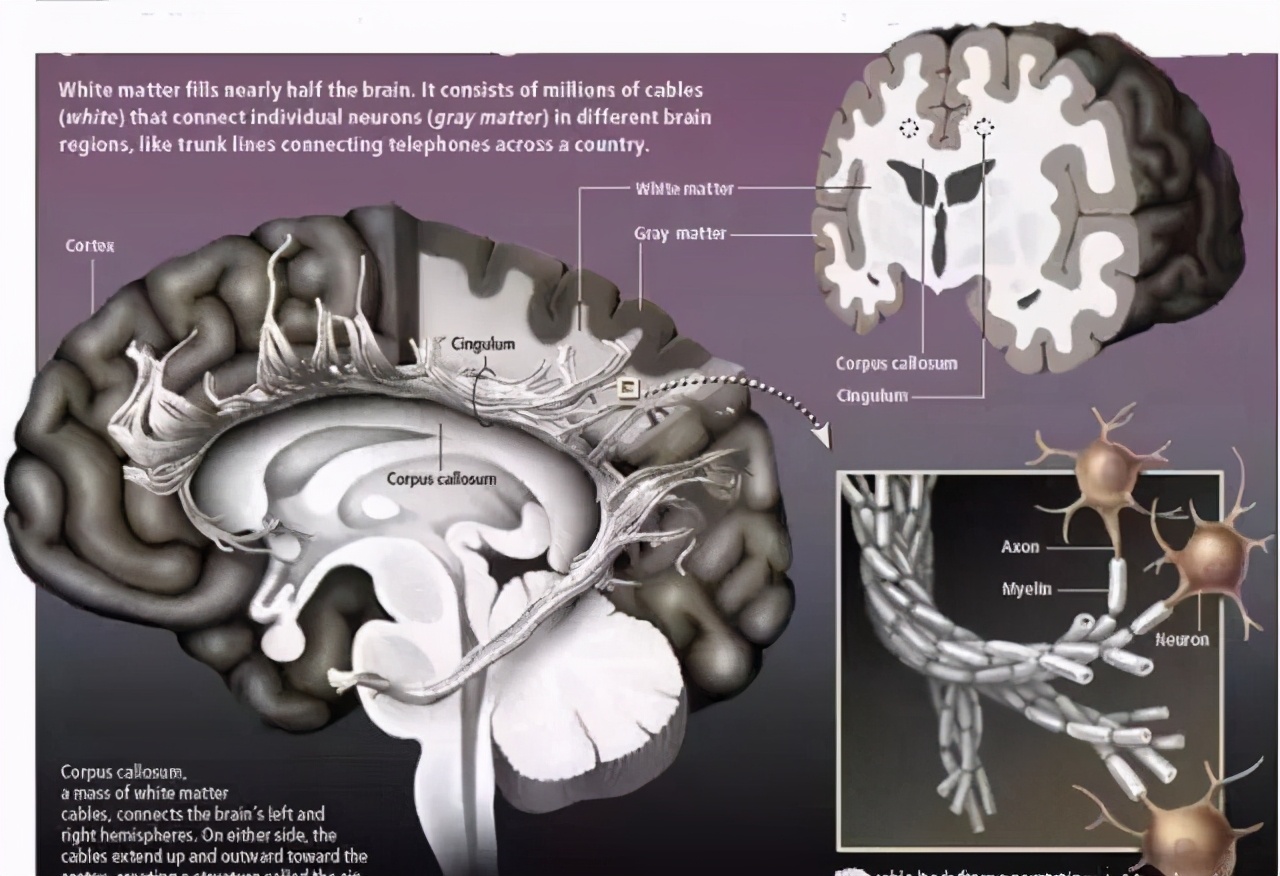 脑白质位置图片