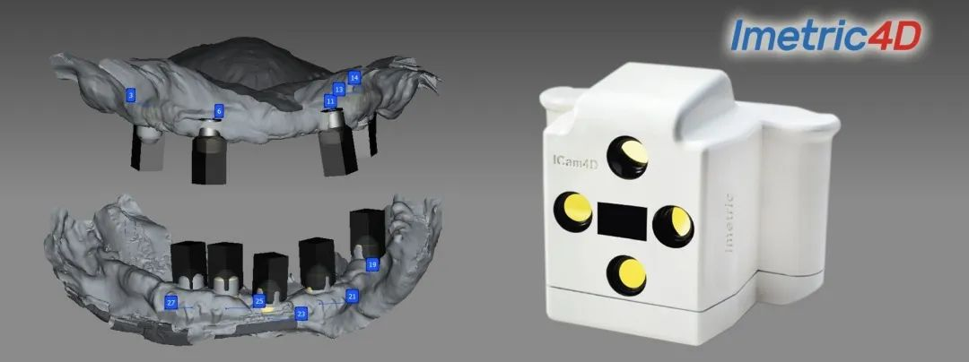 北极星口腔数字化种植面扫黑科技"icam4d口外扫"星突破