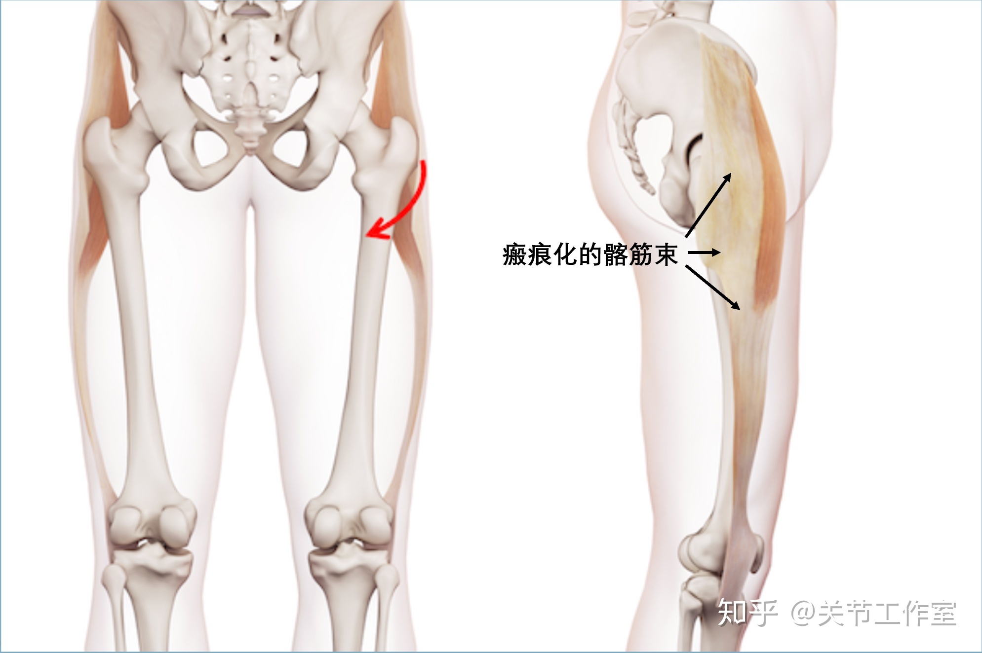 幸福好时光|延年益寿效果排前三的运动,走路居然没有上榜?