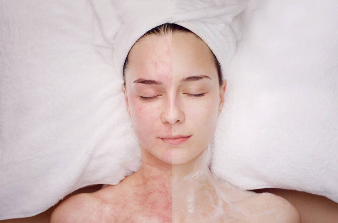 水氧活肤补水效果明显,足以对抗秋季肌肤干燥