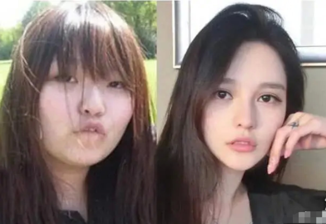 网红真逆袭了!周扬青"整容脸"火遍全网,素颜照却让人看呆