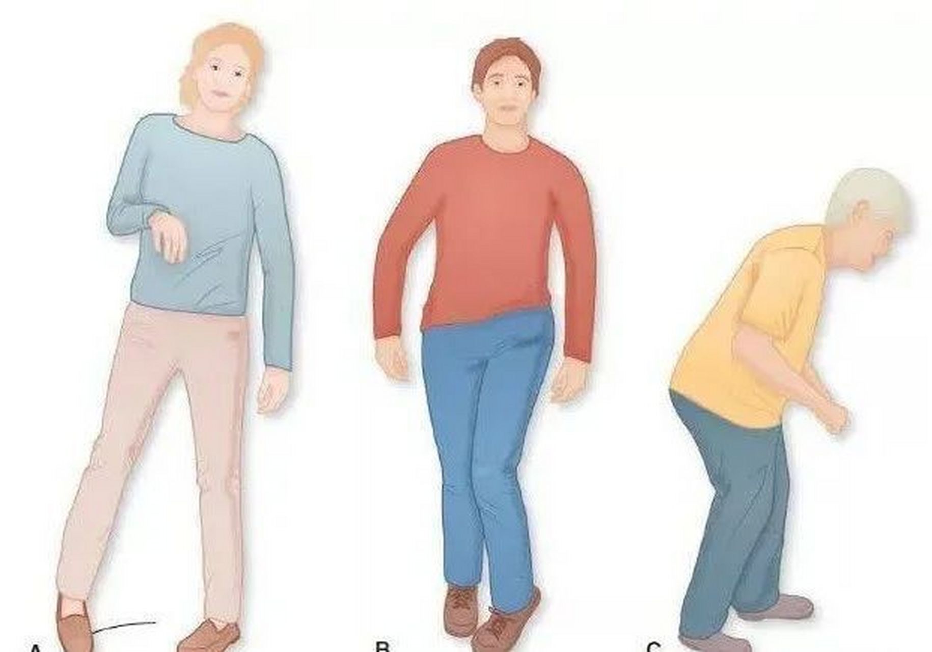 像遗传以及神经退行性原因造成的小脑性共济失调会出现进行性和无法