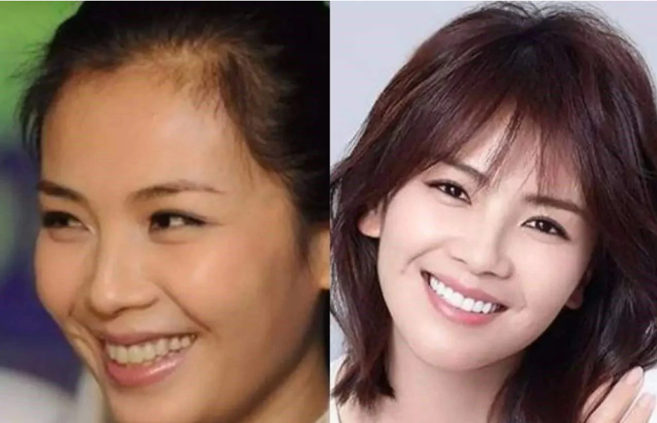 女明星"假牙"大pk,谁的嘴巴闭不上,谁的嘴里藏着一套房?