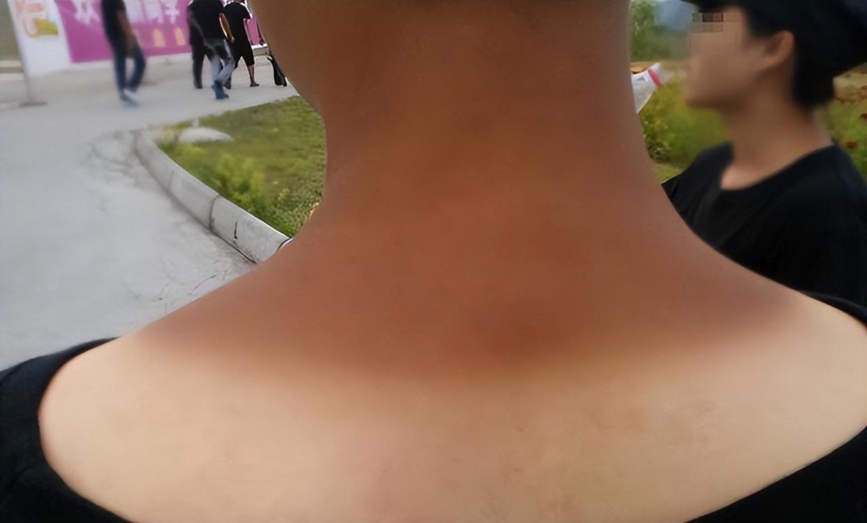 防晒霜要涂在哪个步骤?错误的步骤,涂了也是"白用功"