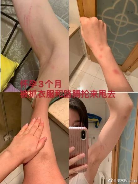 推荐|短跑冠军张培萌妻子称被家暴,称其不仅出轨还袭击家中老人,网友怒了