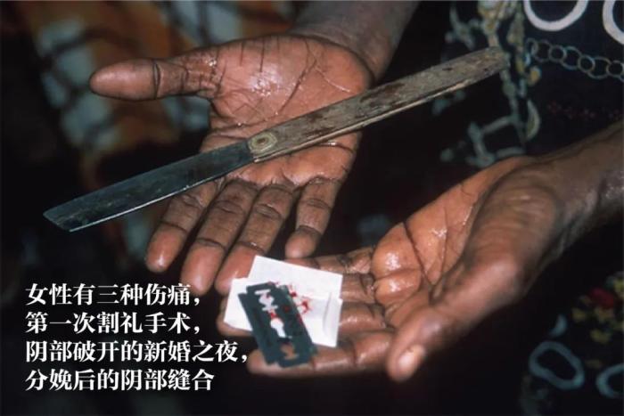 印尼6000万女性遭受生殖器割礼,男性也难逃厄运