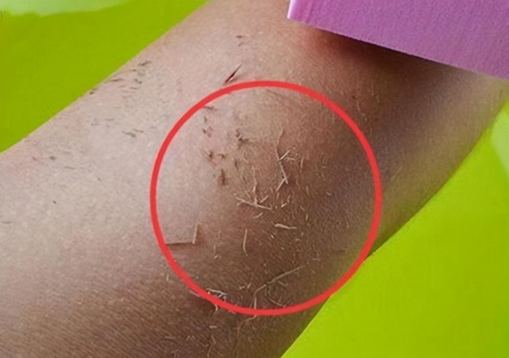 洗澡时被搓掉的黑泥是什么?显微镜放大后,瞬间感到一阵"恶寒"