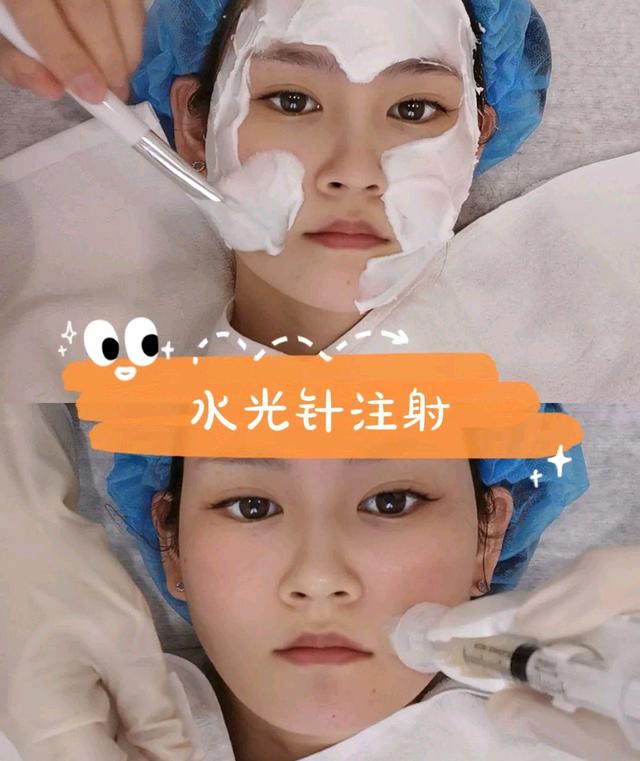 光子嫩肤能和其他医美一起做吗?要根据情况选择合适的项目和顺序