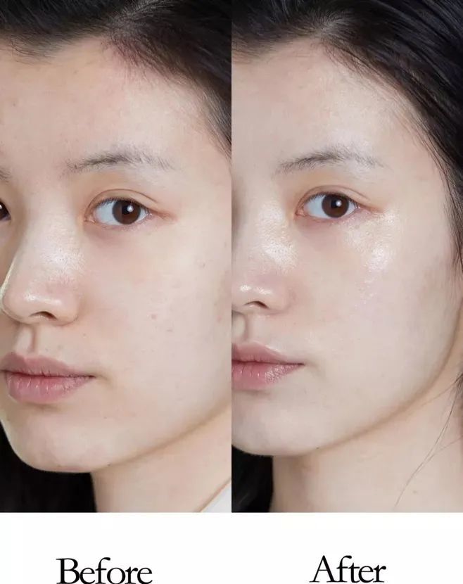 进来一起了解水光项目吧