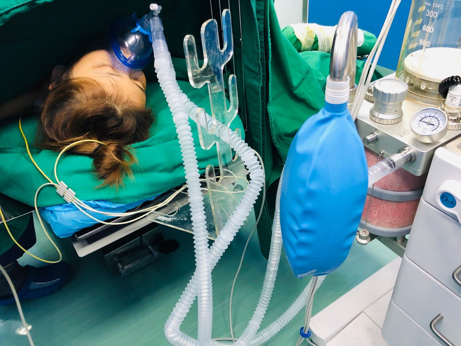 急性造血停滞的患者,发现后应及时就医,危急重症需要住院治疗