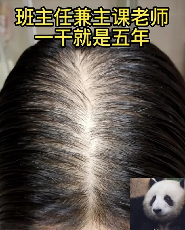 年轻女教师晒秃顶照片,辞职当保洁拒绝精神内耗,心情好多了