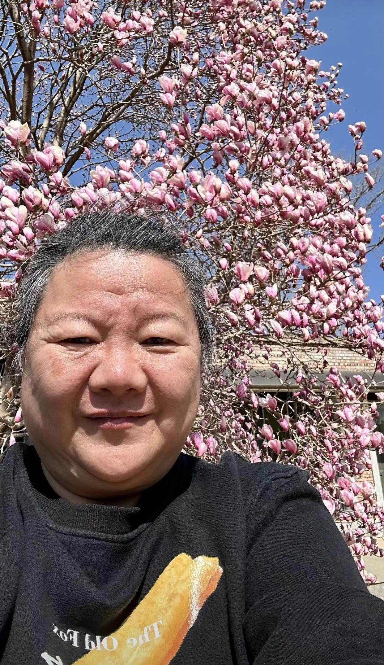 陈凯歌前妻近照身体状况引担忧,脸上毛发全掉牙稀疏