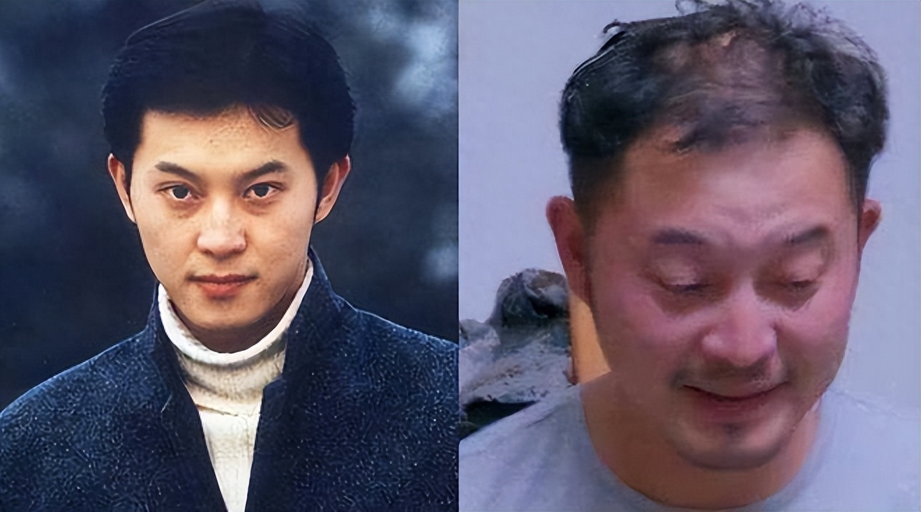 回顾焦恩俊中年发福吴彦祖发际线后移岁月果然是把杀猪刀