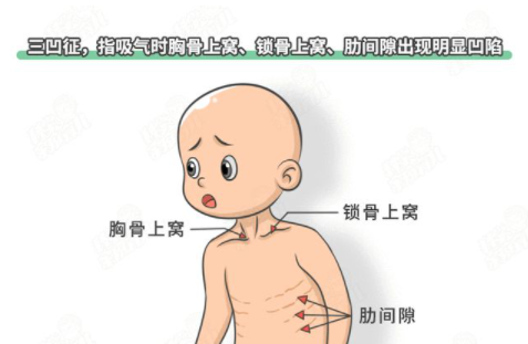 这十个氧疗的知识点千万不要错过——乐普佳漾Ⅱlf03b知识点