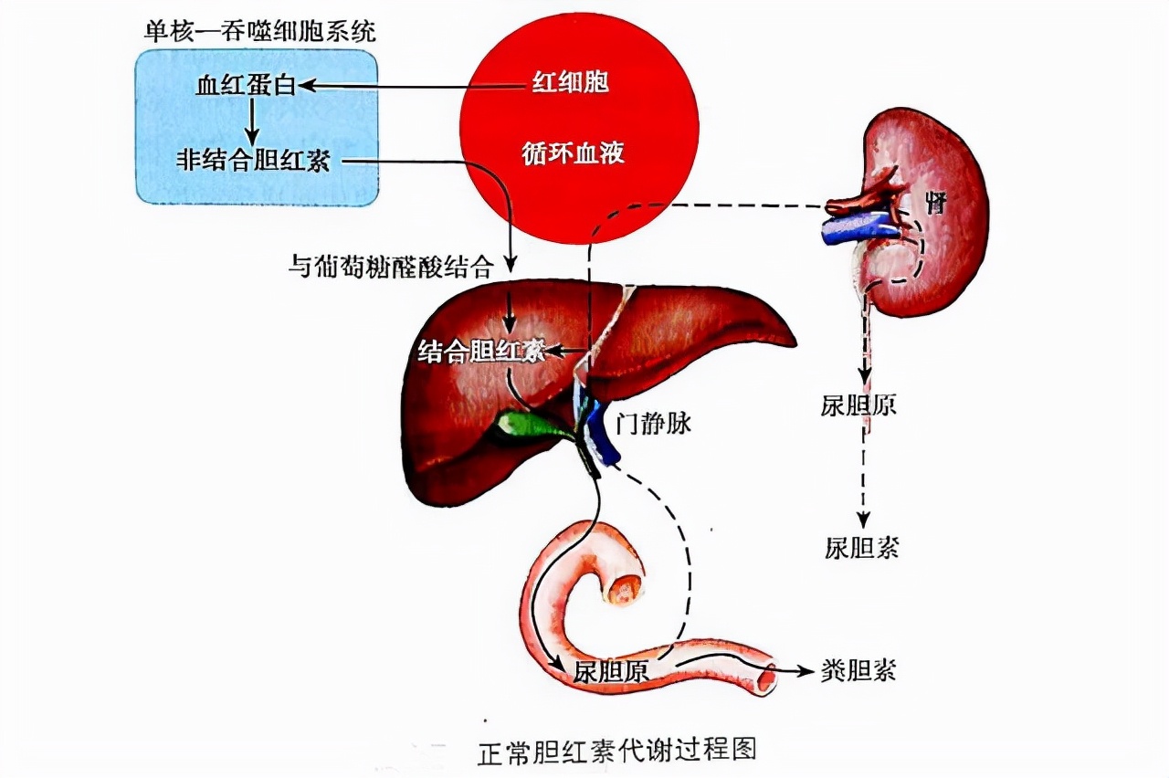 胆红素正常代谢示意图图片