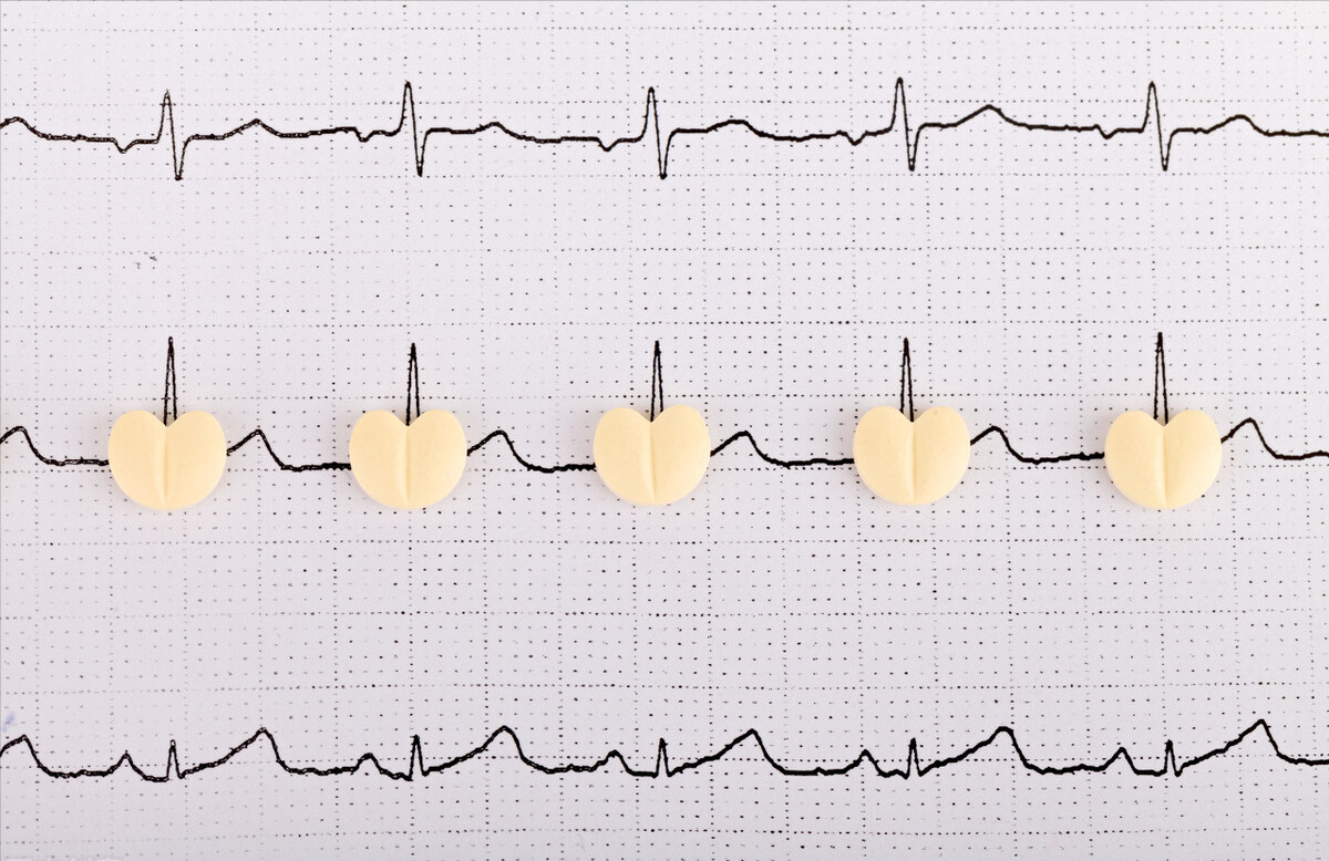 两个非主要因素即为脑栓塞的高危患者,这些患者更容易形成心房内血栓