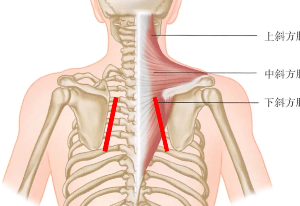 如何缓解斜方肌导致的直角肩?