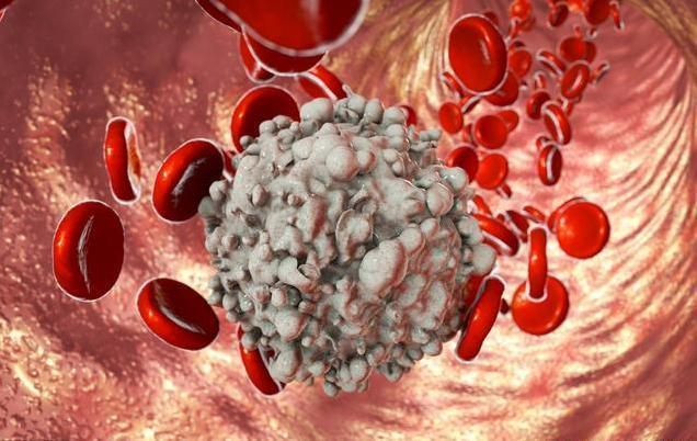 小编浅谈,什么原因会导致"血癌"?你知道几个呢?