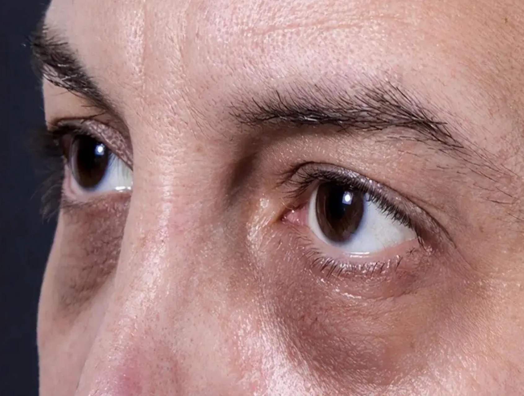 眼神猥琐----长期的肾亏 2. 瞳孔不圆----肾阴虚 3.