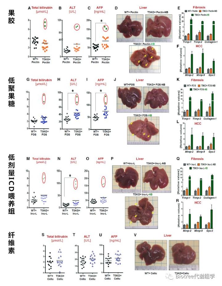 百趣代谢组学文献分享:膳食纤维或致肝癌?