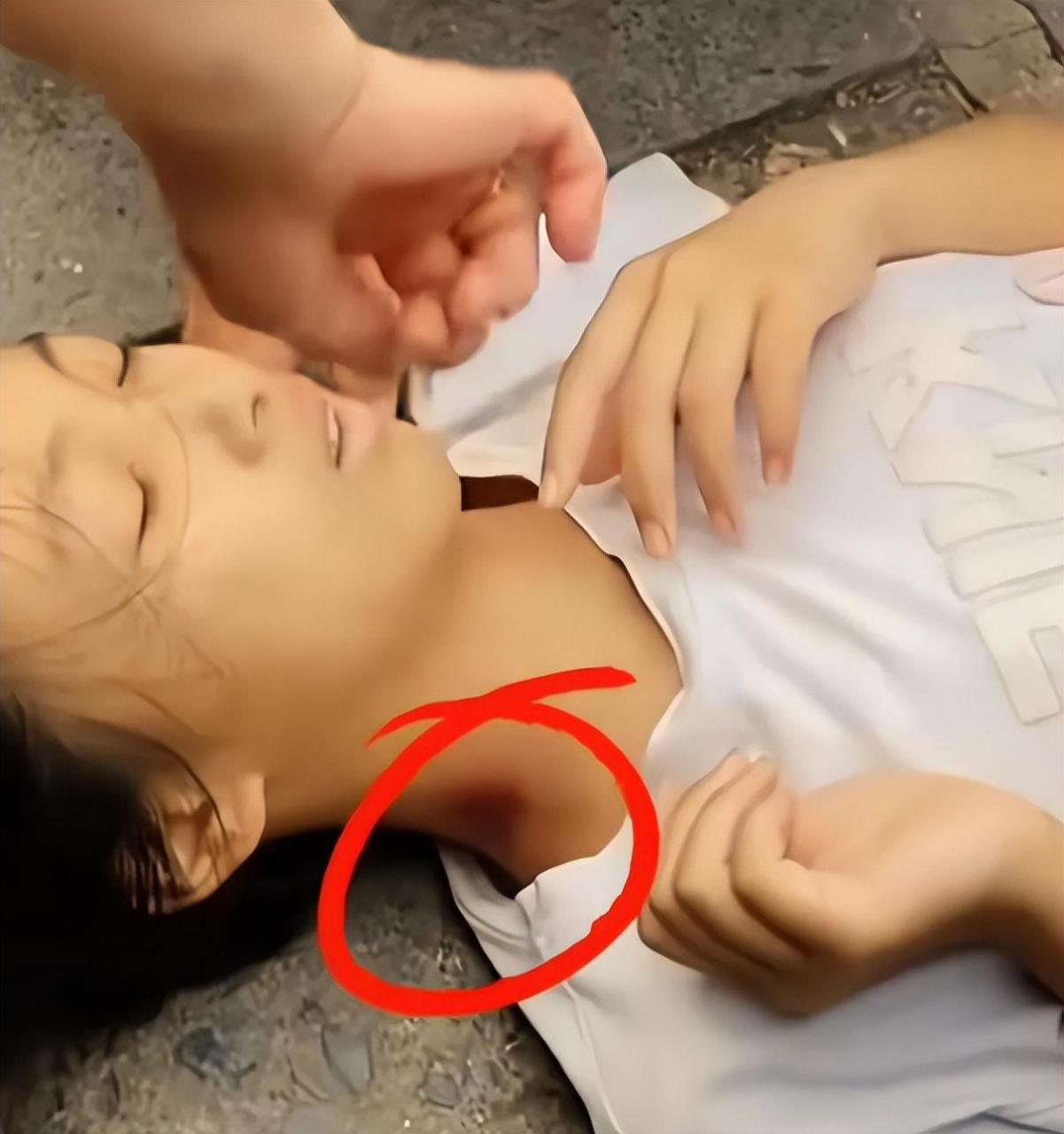 重庆一女孩,中暑晕倒在路边,行人来往却无人敢搀扶.