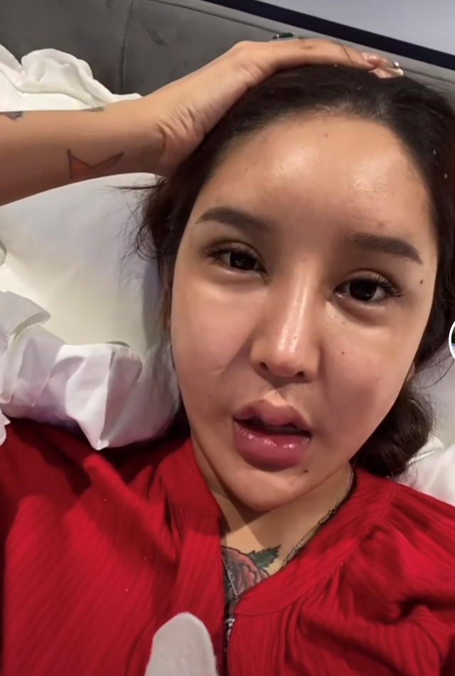 网红自曝整容后遗症,假体歪斜眼睛抽搐,却仍然不愿停下