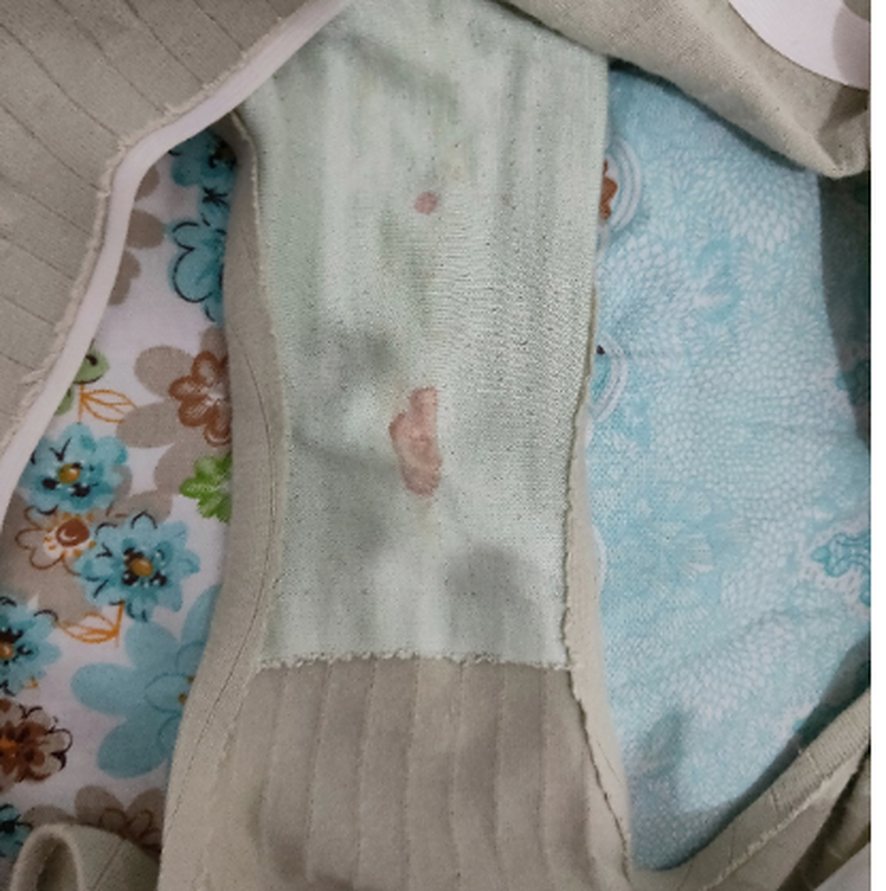 我女儿才7岁,昨天给他换内裤的时候发现上面有血迹.