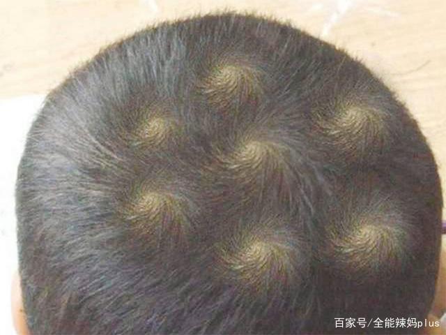 “仨旋男孩不好找!”孩子头旋数量代表命运?听听专业的解释