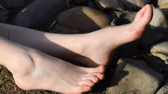 女人健不健康,看脚"先知晓",对照看看你的脚有没有这6个特点
