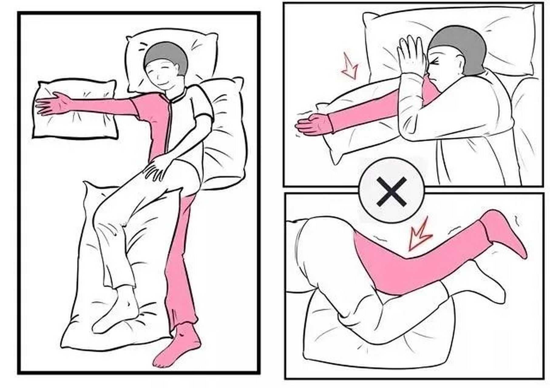 是为了保持肢体的良好功能而将其摆放成一种体位或姿势