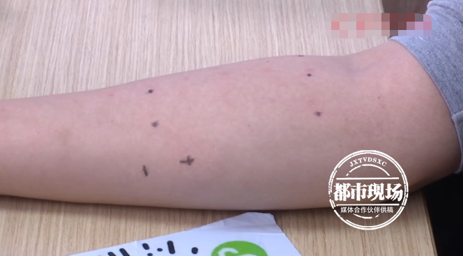 养猫2年,女子突然对猫毛过敏了,这是咋回事?