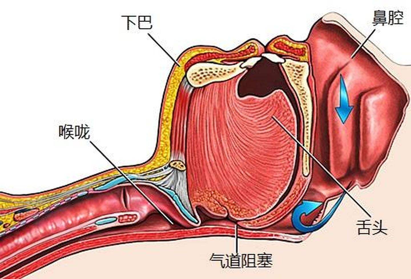 打鼾原理图片