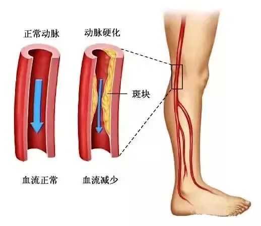 膎动脉位置图片图片