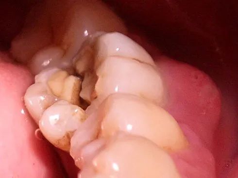 城市套路深我要回农村?这个套路是你需要的