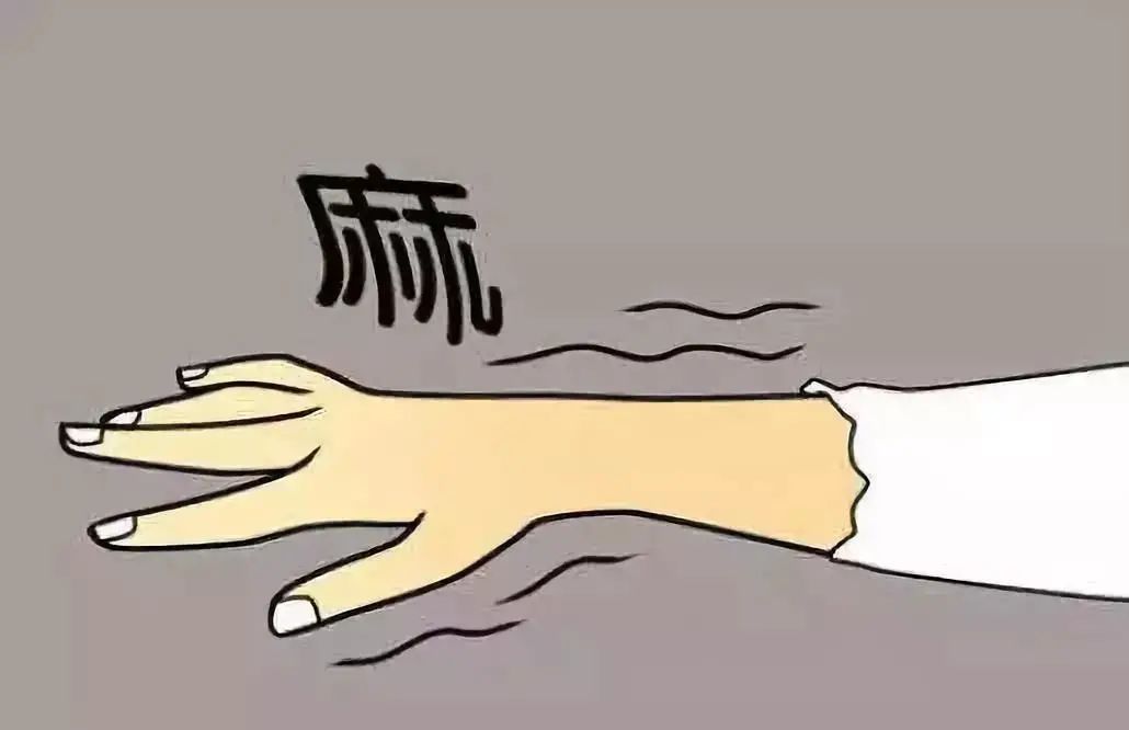 「干货」水肿,抽筋,手脚麻痛……这些孕期四肢不适,你中招了吗?