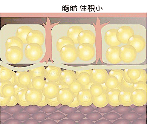 新的瘦脸黑科技"雕刻家",无创无痛是怎么解决脂肪的?