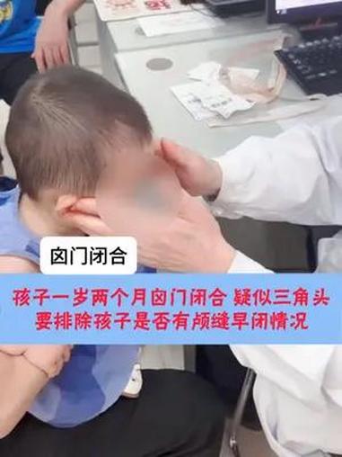 宝宝一岁两个月囟门闭合,前额部小,疑似三角头!
