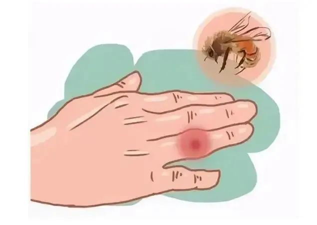 急诊故事|狂"蜂"来袭,他被蜇了120多个伤口
