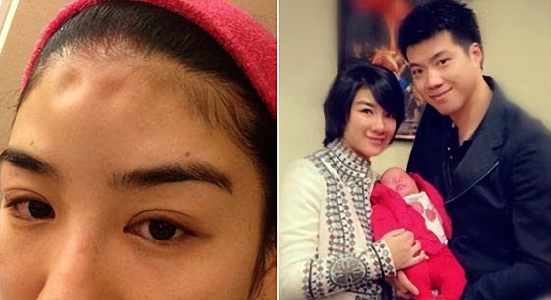 被丈夫打到坐轮椅,黄奕5年离婚两次,仍不忘捐上百万做慈善