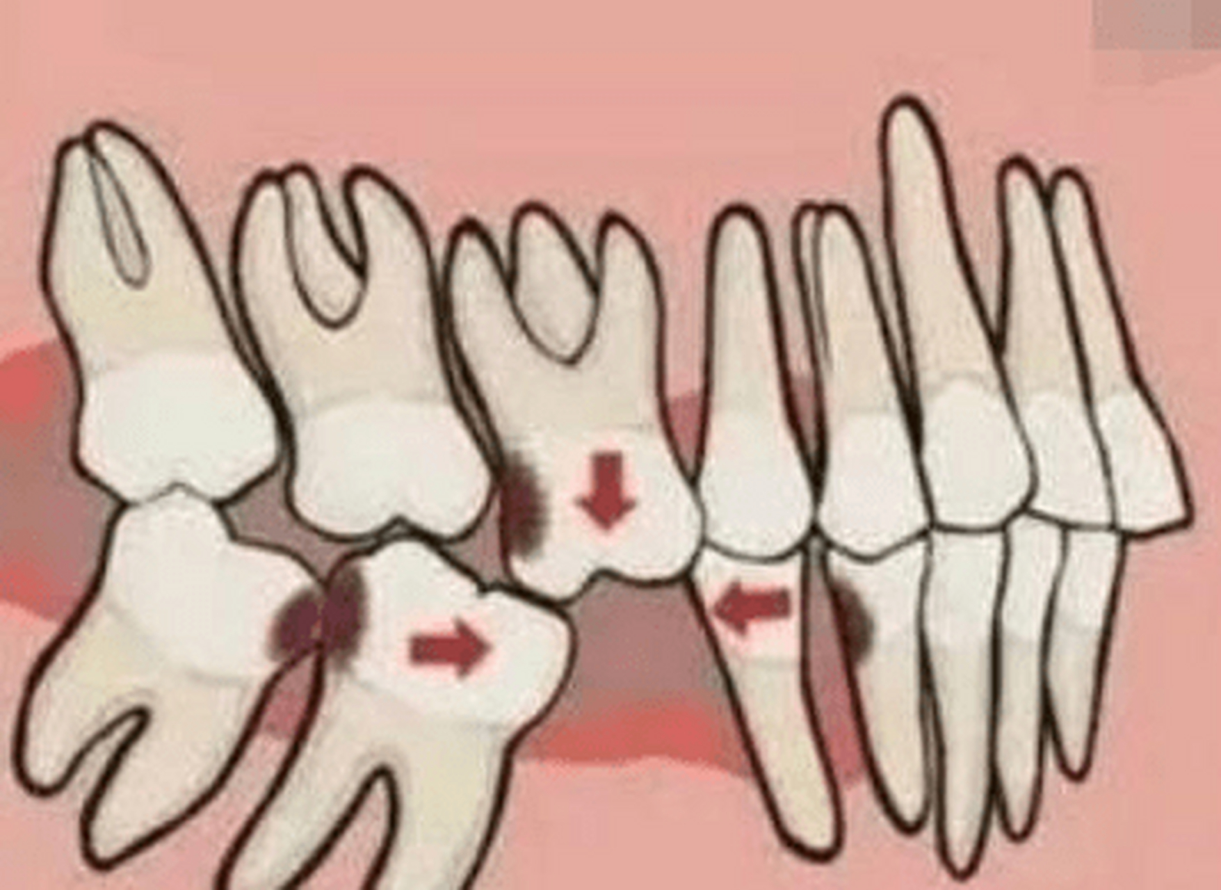 俗语说得好"牵一发而动全身",牙齿对身体来说也是这样.