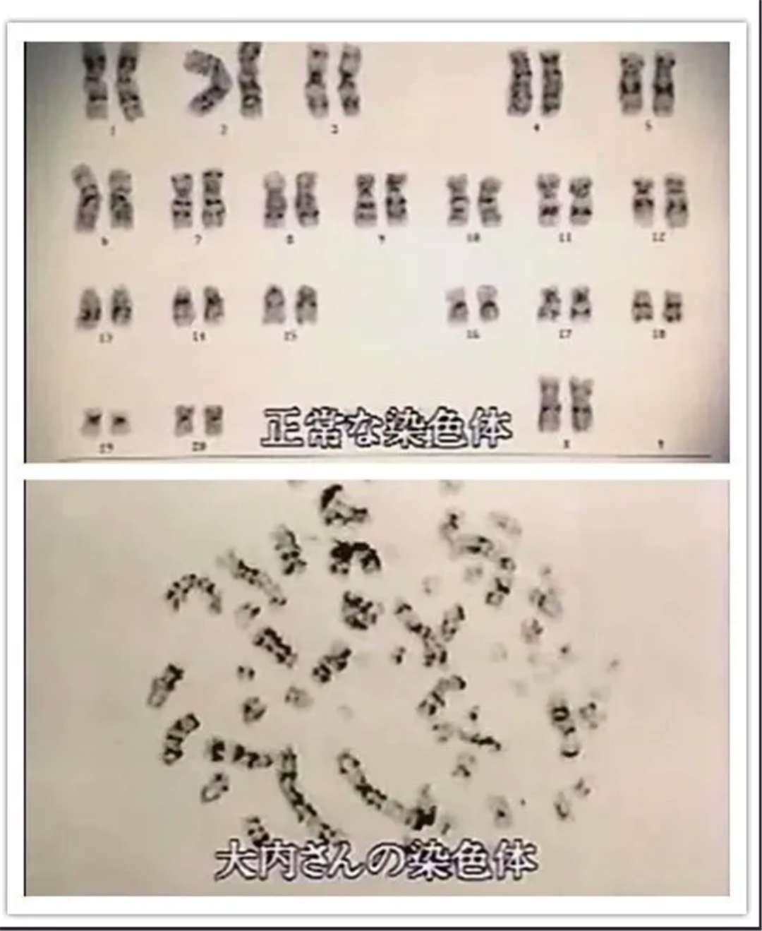 一次核事故让他全身dna断裂,最终看着自己的身体一天天腐烂