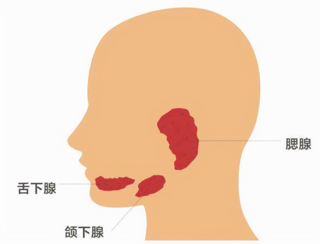 急性化脓性腮腺炎图片