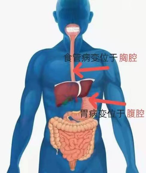 胃的幽门口的位置图图片