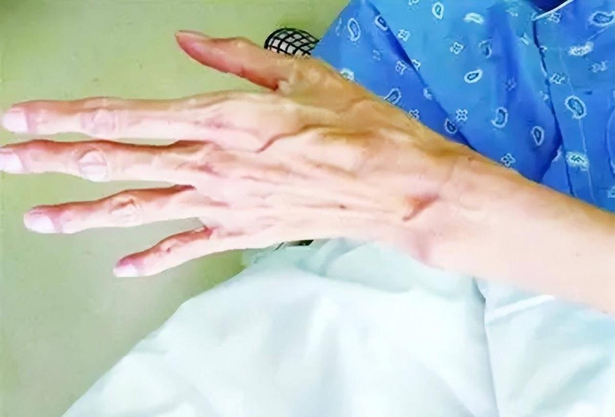 2017年男排主力陆飞病逝留下两个年幼女儿惠若琪送153万善款