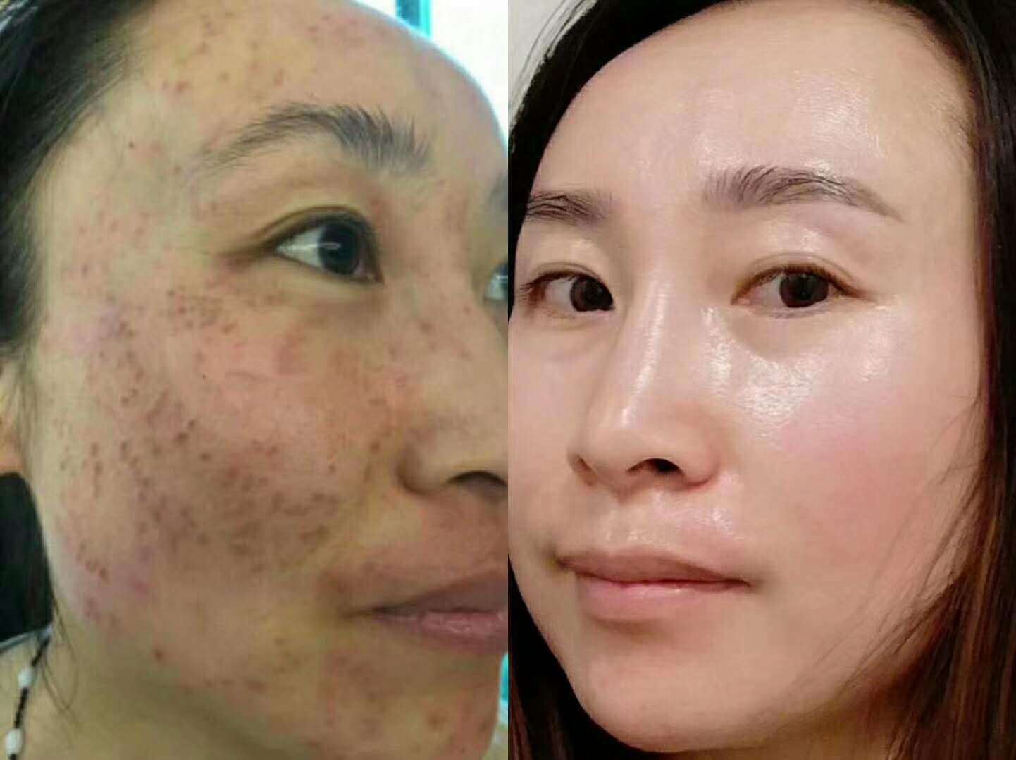 3种美食,或是黄褐斑"橡皮擦",奔四的女人常吃点,保持年轻态