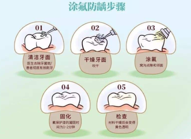 "牙齿涂氟"是什么?对孩子有副作用吗"窝沟封闭"要不要做?