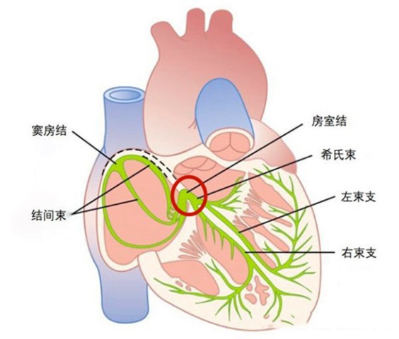 房室结位于koch三角图片