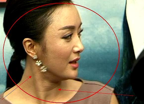 秦岚素颜照大曝光,满脸都是疤?仅一个举动,打脸娱乐圈!