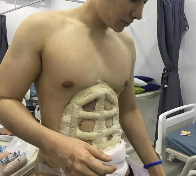 当红男演员"肌肉造假"被拆穿!男人为了长肌肉简直太拼了
